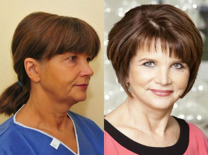 Rimai Vaniarchinai buvo atliktos veido patempimo ir užkritusių viršutinių akių vokų operacijos, detoksikuojamasis liekninamasis kūno įvyniojimas, Negyvosios jūros vonia bei purvo terapija, ozonoterapija, liekninančios procedūros, taip pat Rima su asmenini